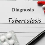 Pitt Scientists Find Clues to Guide Development of Effective Therapies Against Tuberculosis