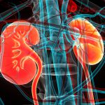 Kidney Disease Intervention Outcomes Encouraging, Despite Null Result