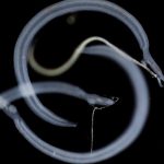 Tracking vampire worms with machine learning − using AI to diagnose schistosomiasis before the parasites causing it hatch in your blood