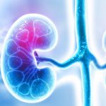 Kidney_epidemic_BlogHeader