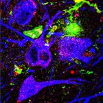 NADPH_Oxidase_ParkinsonsBlogHeader