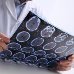 Doctor examining MRI images of patient with multiple sclerosis at table in clinic, closeup