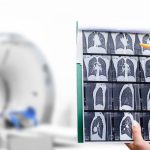 Radiologist showing tomography scan of a patient’s lungs over of CT machine. Treatment of lung diseases, pneumonia, coronavirus, covid, cancer, tuberculosis