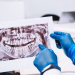 hands wearing blue latex gloves holding an oral x-ray.