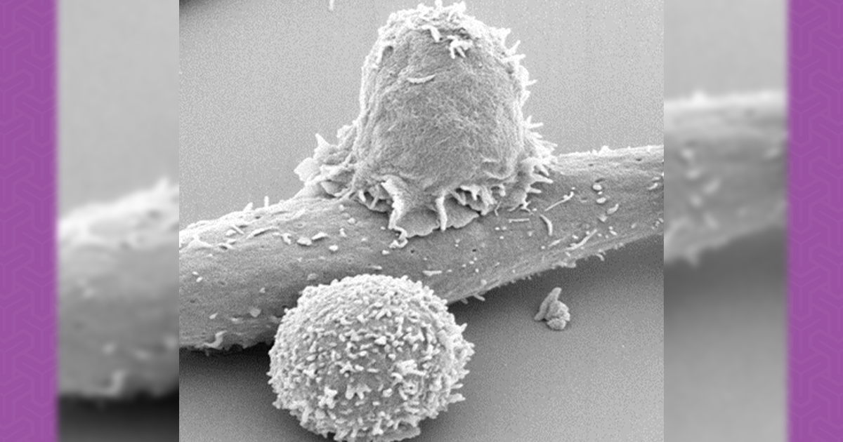 Nourishing T Cells to Fight Cancer